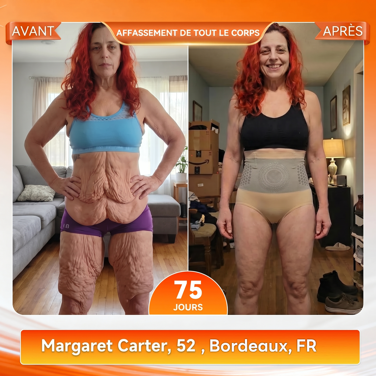 Boutique Officielle de la Marque 🎉 𝑨𝑳𝑳𝒀𝑩𝑬𝑬® 2026 Moringa & Berbérine 4-en-1 Micro-Particules Sculptantes & Brûlantes de Graisse Shorts