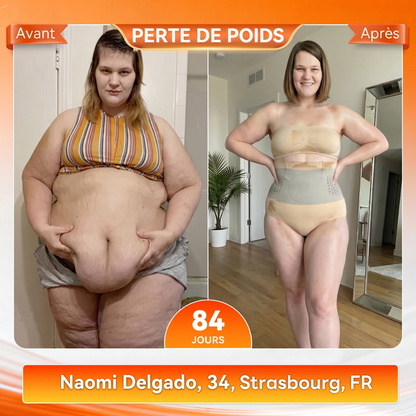 Boutique Officielle de la Marque 🎉 𝑨𝑳𝑳𝒀𝑩𝑬𝑬® 2026 Moringa & Berbérine 4-en-1 Micro-Particules Sculptantes & Brûlantes de Graisse Shorts